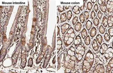 Anti-AKT antibody [HL2915] used in IHC (Paraffin sections) (IHC-P). GTX640258