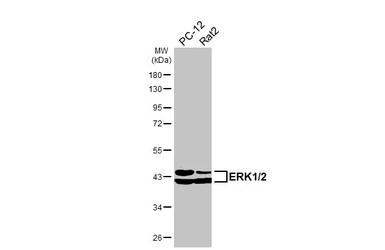 Anti-ERK1/2 antibody [HL2946] used in Western Blot (WB). GTX640331