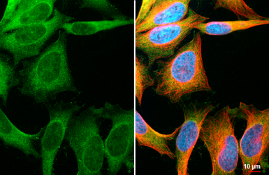 Anti-ERK1/2 antibody [HL2946] used in Immunocytochemistry/ Immunofluorescence (ICC/IF). GTX640331