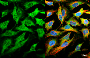 Anti-ERK1/2 antibody [HL2948] used in Immunocytochemistry/ Immunofluorescence (ICC/IF). GTX640333