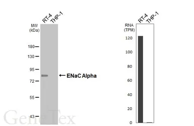 Anti-ENaC Alpha antibody [HL2967] used in Western Blot (WB). GTX640354