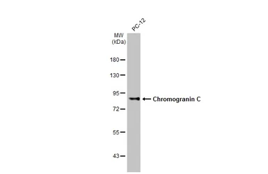 Anti-Chromogranin C antibody [HL2992] used in Western Blot (WB). GTX640402