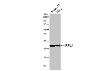 Anti-RPL4 antibody [HL3008] used in Western Blot (WB). GTX640421