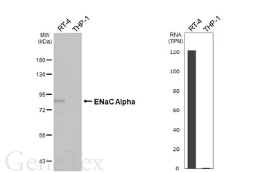 Anti-ENaC Alpha antibody [HL3027] used in Western Blot (WB). GTX640465