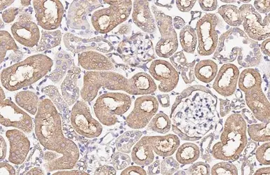 Anti-ENaC Alpha antibody [HL3027] used in IHC (Paraffin sections) (IHC-P). GTX640465