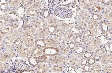 Anti-ENaC Alpha antibody [HL3027] used in IHC (Paraffin sections) (IHC-P). GTX640465