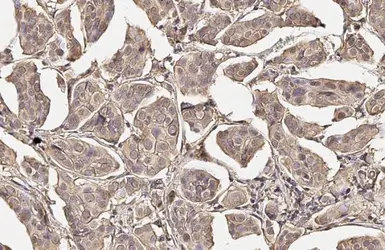 Anti-Somatostatin receptor 2 antibody [HL3078] used in IHC (Paraffin sections) (IHC-P). GTX640524