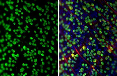 Anti-RBPMS antibody [HL3090] used in IHC (Whole mount) (IHC-Wm). GTX640536