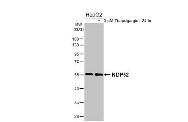 Anti-NDP52 antibody [HL3126] used in Western Blot (WB). GTX640612