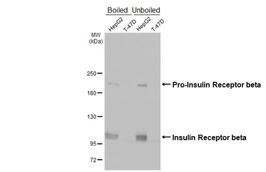 Anti-Insulin Receptor beta antibody [HL3132] used in Western Blot (WB). GTX640624