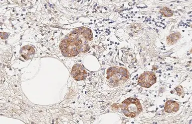 Anti-Insulin Receptor beta antibody [HL3132] used in IHC (Paraffin sections) (IHC-P). GTX640624