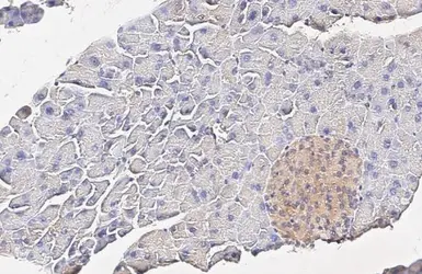 Anti-Insulin Receptor beta antibody [HL3132] used in IHC (Paraffin sections) (IHC-P). GTX640624