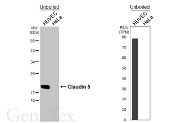 Anti-Claudin 5 antibody [HL3156] used in Western Blot (WB). GTX640666