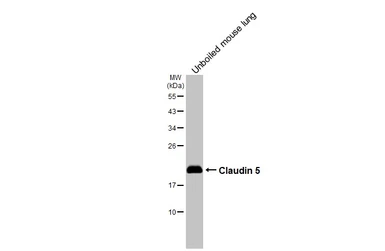 Anti-Claudin 5 antibody [HL3156] used in Western Blot (WB). GTX640666