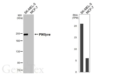 Anti-PIKfyve antibody [HL3158] used in Western Blot (WB). GTX640668