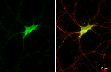 Anti-Kv1.2 antibody [HL3163] used in Immunocytochemistry/ Immunofluorescence (ICC/IF). GTX640673