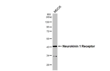 Anti-Neurokinin 1 Receptor antibody [HL3195] used in Western Blot (WB). GTX640834