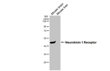 Anti-Neurokinin 1 Receptor antibody [HL3195] used in Western Blot (WB). GTX640834