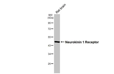 Anti-Neurokinin 1 Receptor antibody [HL3195] used in Western Blot (WB). GTX640834