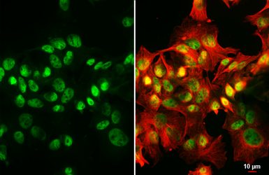 Anti-HNF1 alpha antibody [HL3229] used in Immunocytochemistry/ Immunofluorescence (ICC/IF). GTX640870