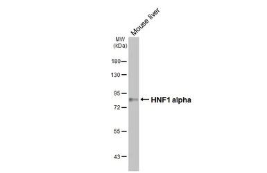 Anti-HNF1 alpha antibody [HL3229] used in Western Blot (WB). GTX640870