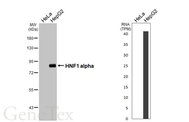 Anti-HNF1 alpha antibody [HL3229] used in Western Blot (WB). GTX640870