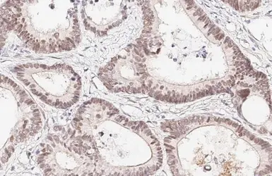 Anti-HNF1 alpha antibody [HL3229] used in IHC (Paraffin sections) (IHC-P). GTX640870