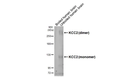 Anti-KCC2 antibody [GT16] used in Western Blot (WB). GTX640897