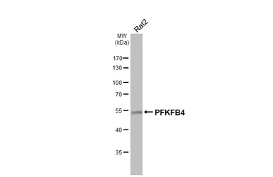 Anti-PFKFB4 antibody [HL3254] used in Western Blot (WB). GTX640901