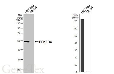 Anti-PFKFB4 antibody [HL3254] used in Western Blot (WB). GTX640901