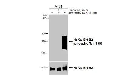 Anti-Her2 / ErbB2 (phospho Tyr1139) antibody [HL3272] used in Western Blot (WB). GTX640926