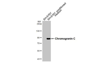 Anti-Chromogranin C antibody [HL3311] used in Western Blot (WB). GTX641073