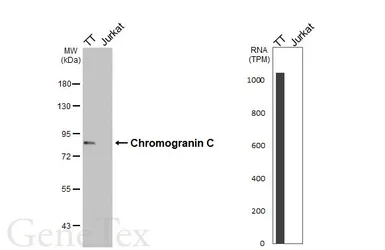 Anti-Chromogranin C antibody [HL3311] used in Western Blot (WB). GTX641073