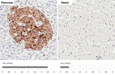 Anti-Chromogranin C antibody [HL3311] used in IHC (Paraffin sections) (IHC-P). GTX641073