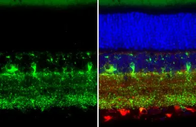 Anti-Chromogranin C antibody [HL3311] used in IHC (Paraffin sections) (IHC-P). GTX641073