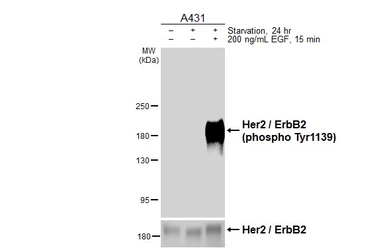 Anti-Her2 / ErbB2 (phospho Tyr1139) antibody [HL3312] used in Western Blot (WB). GTX641074