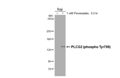 Anti-PLCG2 (phospho Tyr759) antibody [HL3329] used in Western Blot (WB). GTX641094