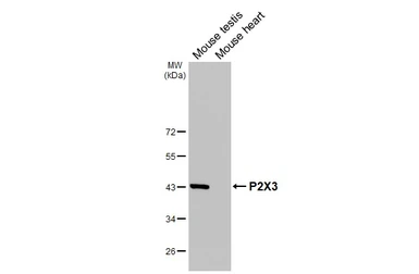 Anti-P2X3 antibody [HL3347] used in Western Blot (WB). GTX641119