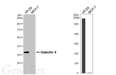 Anti-Galectin 4 antibody [HL3350] used in Western Blot (WB). GTX641127