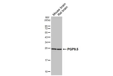 Anti-PGP9.5 antibody [HL3391] used in Western Blot (WB). GTX641211