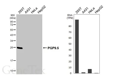 Anti-PGP9.5 antibody [HL3391] used in Western Blot (WB). GTX641211