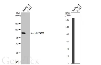 Anti-HKDC1 antibody [HL3464] used in Western Blot (WB). GTX641349