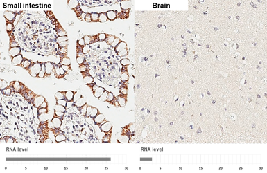 Anti-HKDC1 antibody [HL3464] used in IHC (Paraffin sections) (IHC-P). GTX641349