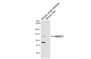 Anti-HKDC1 antibody [HL3464] used in Western Blot (WB). GTX641349