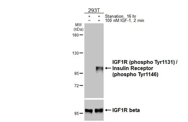 Anti-IGF1R (phospho Tyr1131) / Insulin Receptor (phospho Tyr1146) antibody [HL3537] used in Western Blot (WB). GTX641434