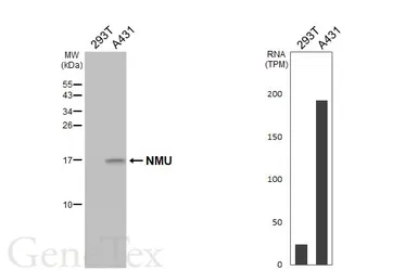 Anti-NMU antibody [HL3549] used in Western Blot (WB). GTX641455