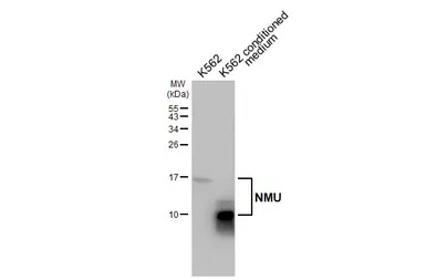 Anti-NMU antibody [HL3549] used in Western Blot (WB). GTX641455