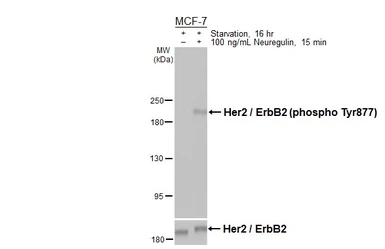 Anti-Her2 / ErbB2 (phospho Tyr877) antibody [HL3558] used in Western Blot (WB). GTX641464