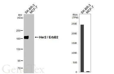 Anti-Her2 / ErbB2 antibody [HL3566] used in Western Blot (WB). GTX641472