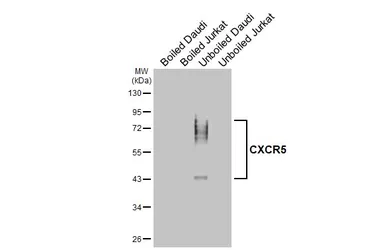 Anti-CXCR5 antibody [HL3568] used in Western Blot (WB). GTX641474